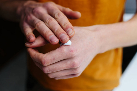 老人手上的药膏.