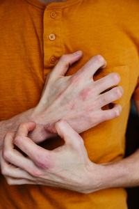 男性自残手部皮肤干燥片状伴有寻常性银屑病湿疹等皮肤病，如真菌斑块皮疹和斑片。自身免疫性遗传病。