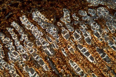 Wood and bark cells of a Sudanese frankincense tree, Boswellia p