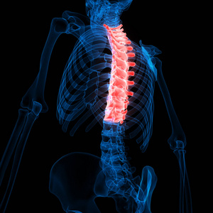 尺骨 炎症 骨骼 插图 医学 损伤 脊骨 照顾 软骨 骨架