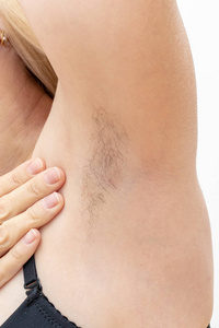 医生测量一个年轻女孩的体温女性问题白底黑腋窝护肤美容理念镜像图标