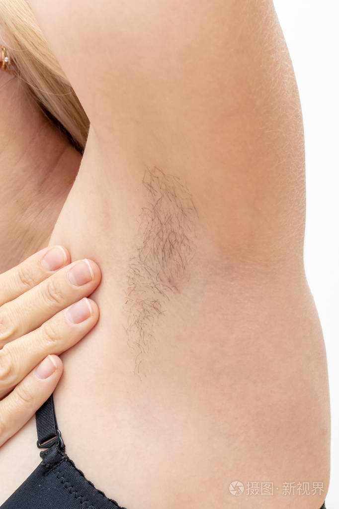 毛茸茸的安德鲁斯一个白人妇女的腋窝特写