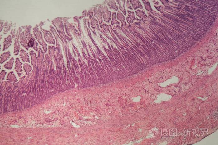 结肠组织切片图图片