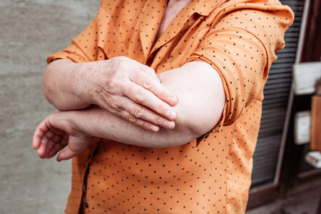 老妇人手肘痛.风湿关节炎关节痛照片