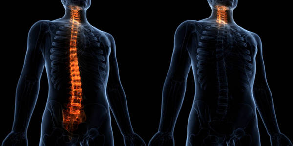 炎症 伤害 照顾 关节炎 肱骨 解剖 人类 骨架 肩胛骨