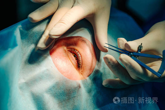 激光视力矫正一个病人和一个外科医生在手术室做眼科手术闭上眼睛病人