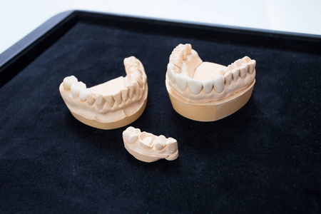 黑底石膏模型上的陶瓷牙齿