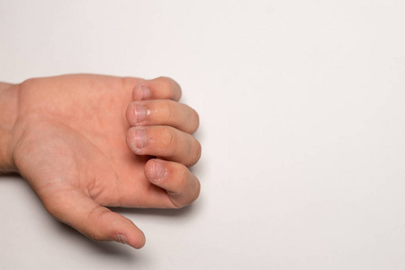 男人手上被咬过的不好看的指甲摄影图