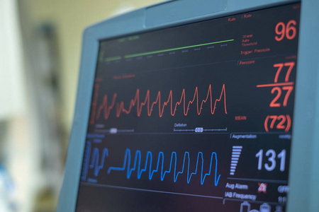 脉冲 心电图 病人 健康 技术 图表 波形 诊断 氧气 签名