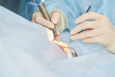 近视眼睛眼科激光显微镜手术.门诊医生.病人的眼睛治疗.