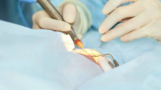 近视眼睛眼科激光显微镜手术.门诊医生.病人的眼睛治疗.