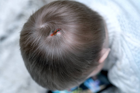 头部因意外造成裂伤.头部外伤的年轻人照片