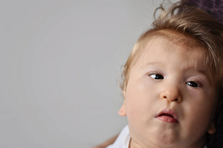 One year old disabled baby boy portrait. Special needs child. 