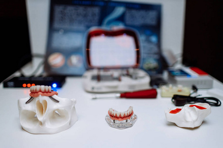 口腔颌面外科整形颌骨模型。