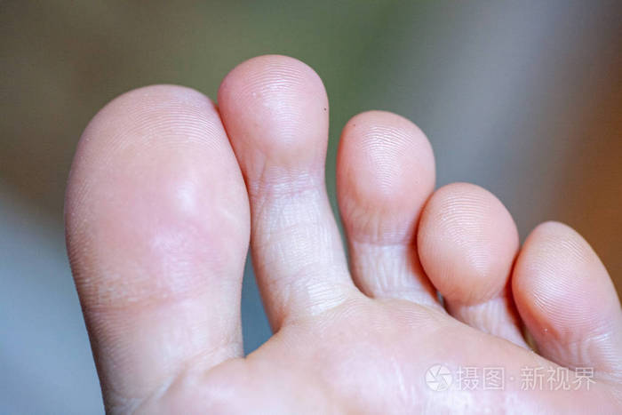 小女孩的脚趾健康美丽