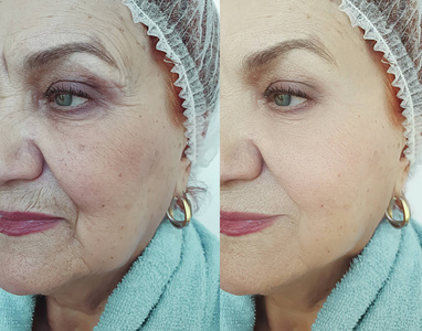 美容学 皮肤科 修饰 注射 眼睛 外科手术 美容师 健康