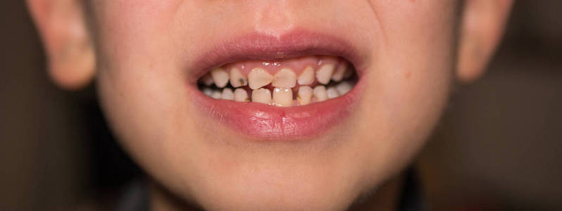 小孩 填满 卫生 医学 照顾 人类 健康 牙医 病人 面对
