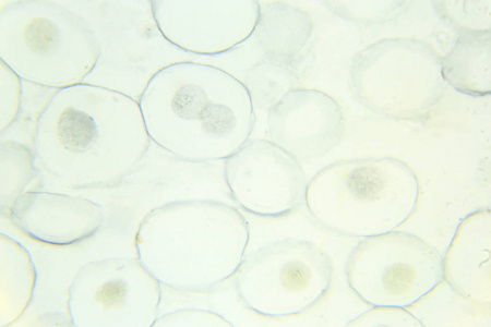 有丝分裂显微镜下有丝分裂马蛔虫卵照片