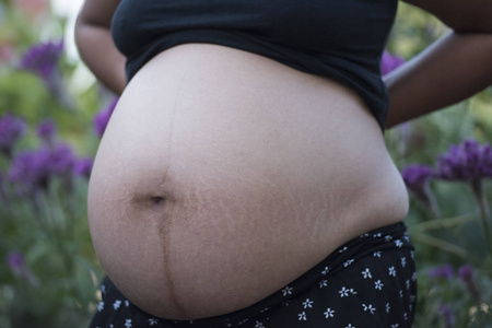 裤子 女孩 女人 脂肪团 饮食 身体 重量 超重 皮肤 卡路里