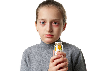 过敏反应，皮疹，近距离观察一个女孩的脸。眼睛和嘴唇皮肤发红和发炎。免疫系统疾病。孩子手里拿着一瓶药片和药片。