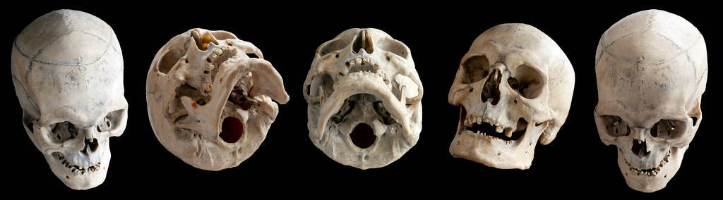 人类头骨。人体解剖学。头骨旋转收集