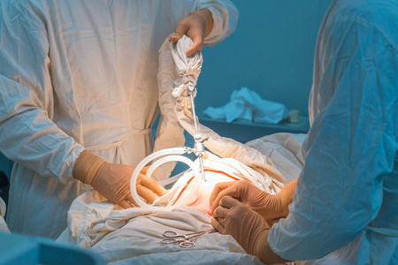 腹腔镜手术在无菌手术室的特写。经皮内环缝合术