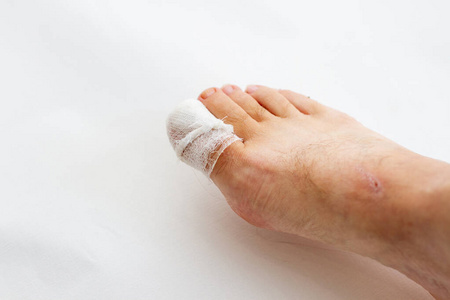 在受伤的手指,拇指,脚趾和脚上绑了绷带照片