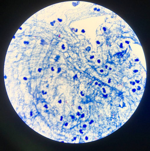 结核分枝杆菌图片