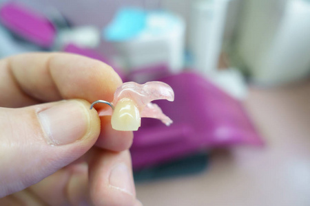 可摘局部义齿图片