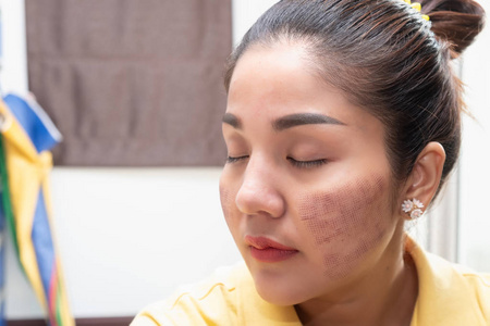 亚洲女性与Sk入院后的表面痕迹