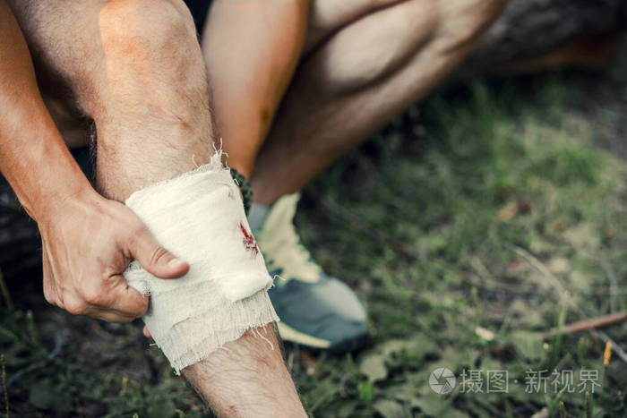 一个年轻人一个游客用绷带包扎伤口