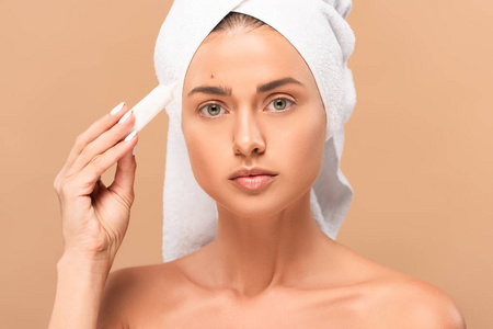 护肤品 女人 痤疮 美丽的 奶油 粉刺 刺激 皮肤科 治疗
