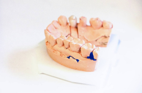 下颚的铸型。在牙医那里训练。解剖牙印。正畸医师教育