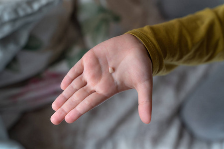 手掌上的孩子那孩子把一颗掉下来的牙齿放在手掌上.手掌上的乳牙.