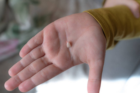 那孩子把一颗掉下来的牙齿放在手掌上.手掌上的乳牙.第一颗牙掉了照片