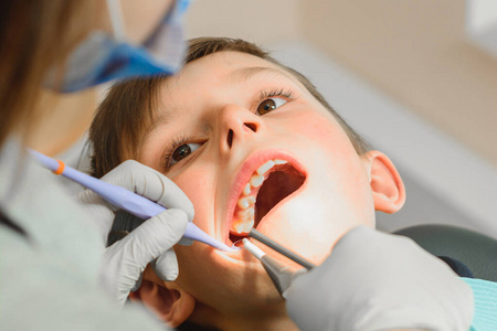 男孩接受了一位正畸医生的检查，他张大了嘴，牙医检查了他的牙齿。