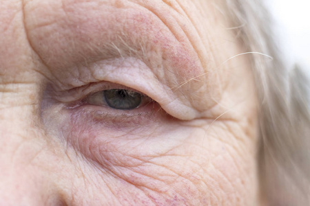 眼睛在画面中央.瞳孔有柔和的焦点,视力差的概念,一切都是模糊的照片