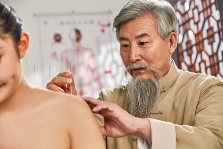中国老年人肩膀痛老中医对病人肩膀进行针灸治疗照片