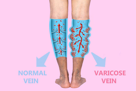 拼贴 照顾 疾病 疼痛 外科手术 湿疹 健康 老的 纹理