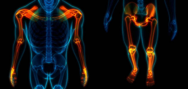 肘部 伤害 关节炎 解剖 生物学 治疗 照顾 插图 医学