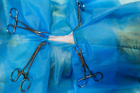 腹部 工具 病人 外科手术 卵巢 健康 外科医生 手术刀