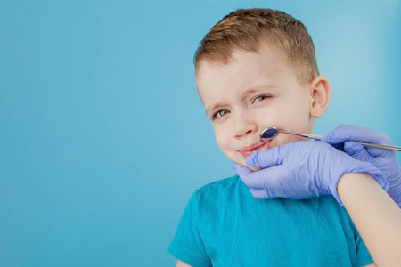 小病人不想在蓝色背景下张开牙医的嘴。但丁治疗牙齿。牙医在牙医诊所治疗小男孩牙齿的特写镜头。
