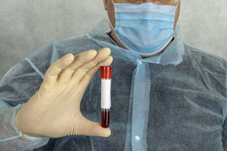 doctor with blood test in hands. Concept of coronavirus quaranti