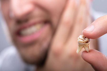 口香糖 支撑 牙医 强调 男人 麻烦 植入 反应 健康 面对