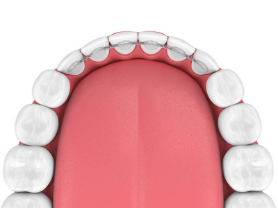 下颌牙粘接固位体的三维显示