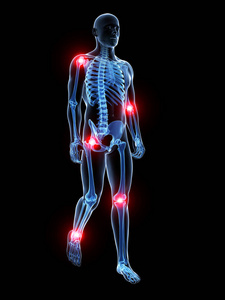 疼痛 三维 医学 抽筋 臀部 解剖学 身体 教育 肌肉 透明的