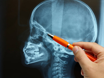 特写医生检查并解释儿童或儿童头骨的x射线图像