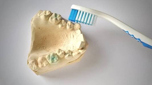 牙刷和假牙。石膏下颌。牙科和保健概念。白色背景。亮黄色和蓝色。粗糙弯曲的牙齿。牙医和正畸医师的帮助
