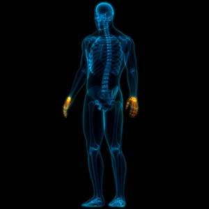 人类 骨质疏松症 股骨 肌肉 骨架 脊柱 插图 信息图表