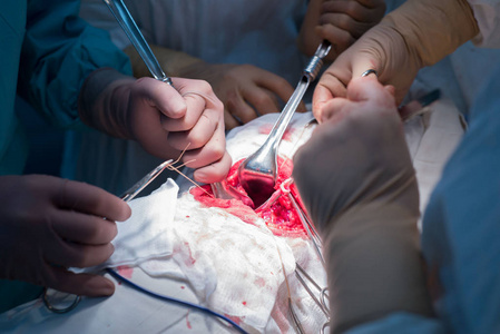 一个有助手的外科医生,在无菌手术室里,对内脏进行手术.照片